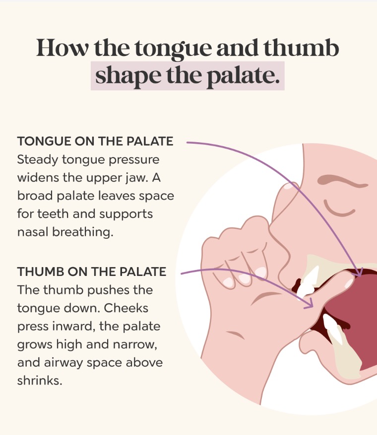 Diagram comparing tongue posture on the palate, which widens the upper jaw, with thumb sucking, which pushes the tongue down and narrows the palate.